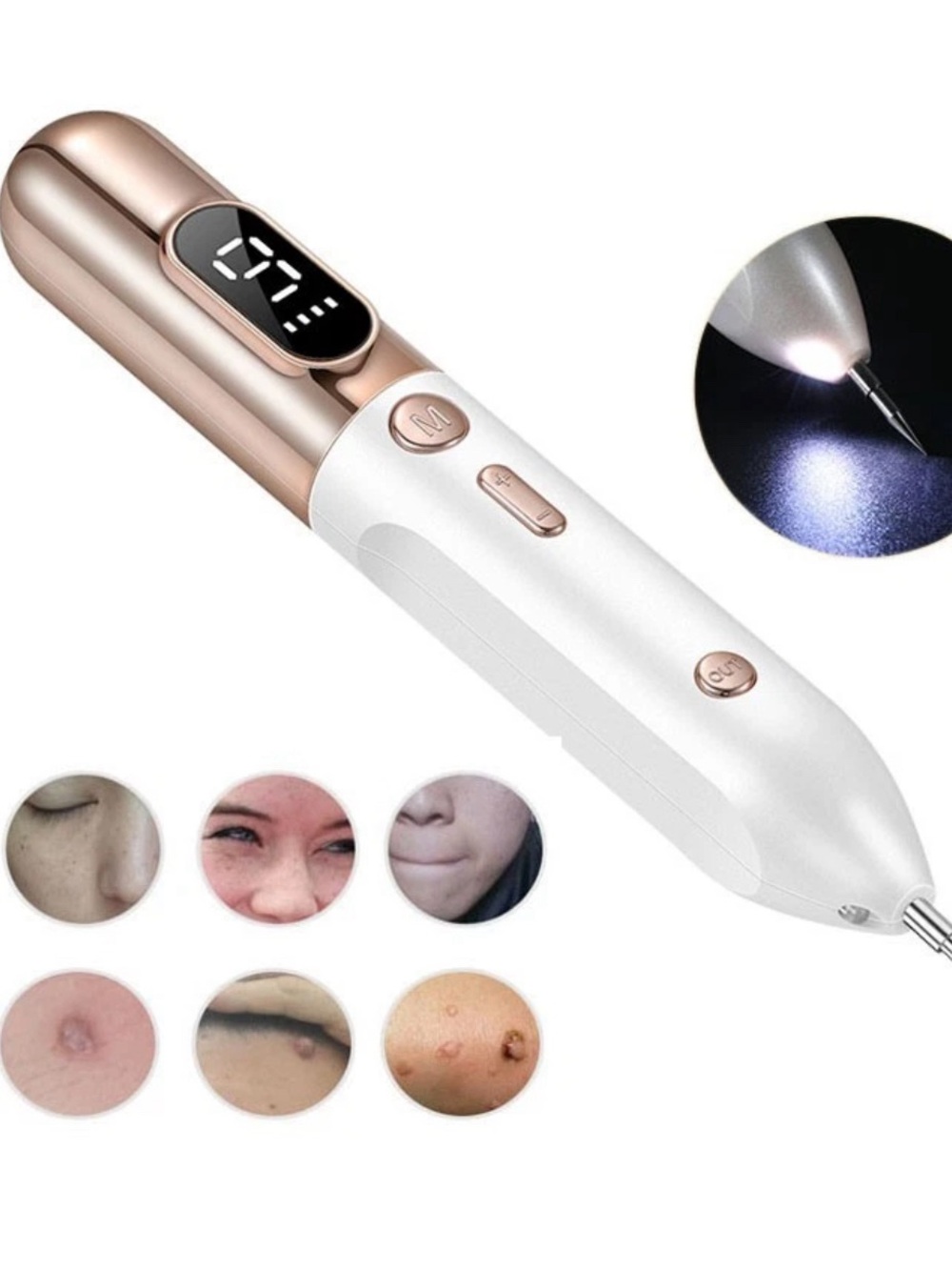 LED White & Rose Gold Plasma Pen for Skin Care - Professional Skin Tag Remover